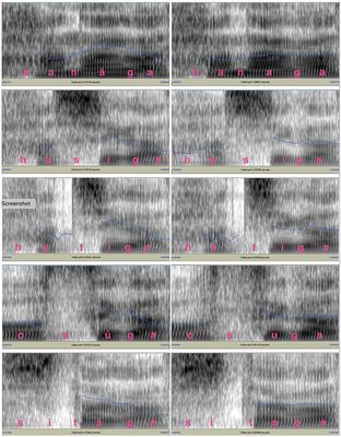 Identification of Minimal Pairs of Japanese Pitch Accent in Noise-Vocoded Speech